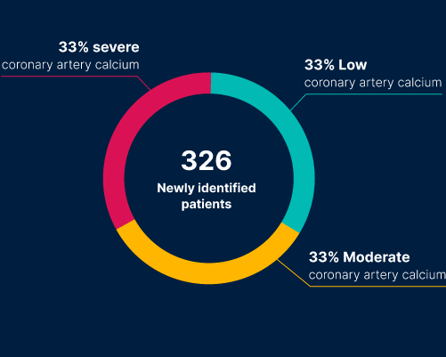 AI Uncovers Hidden Cardiac Ris